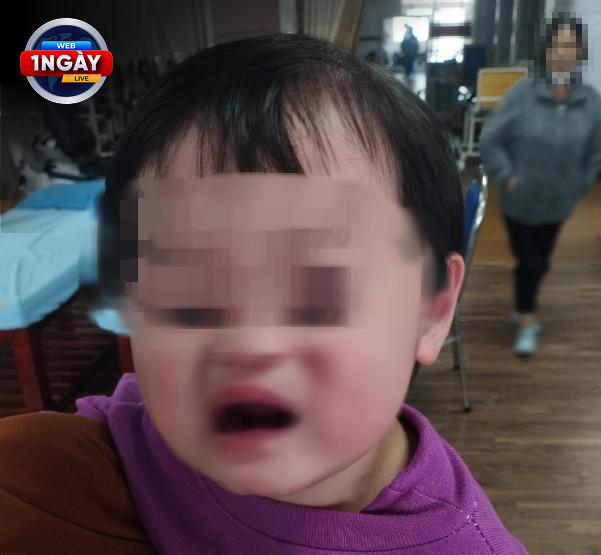 Điều Trị Kịp Thời: Phục Hồi Vận Động Cơ Mặt