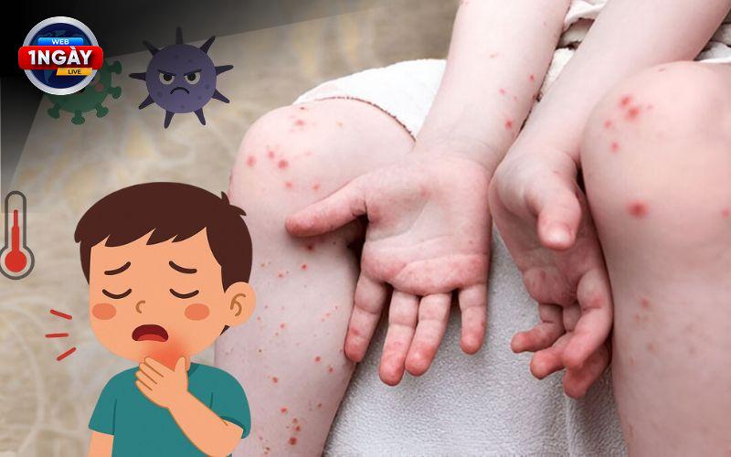 Tóm Lược Vắc Xin: Lá Chắn Vững Chắc Cho Một Cộng Đồng Khỏe Mạnh