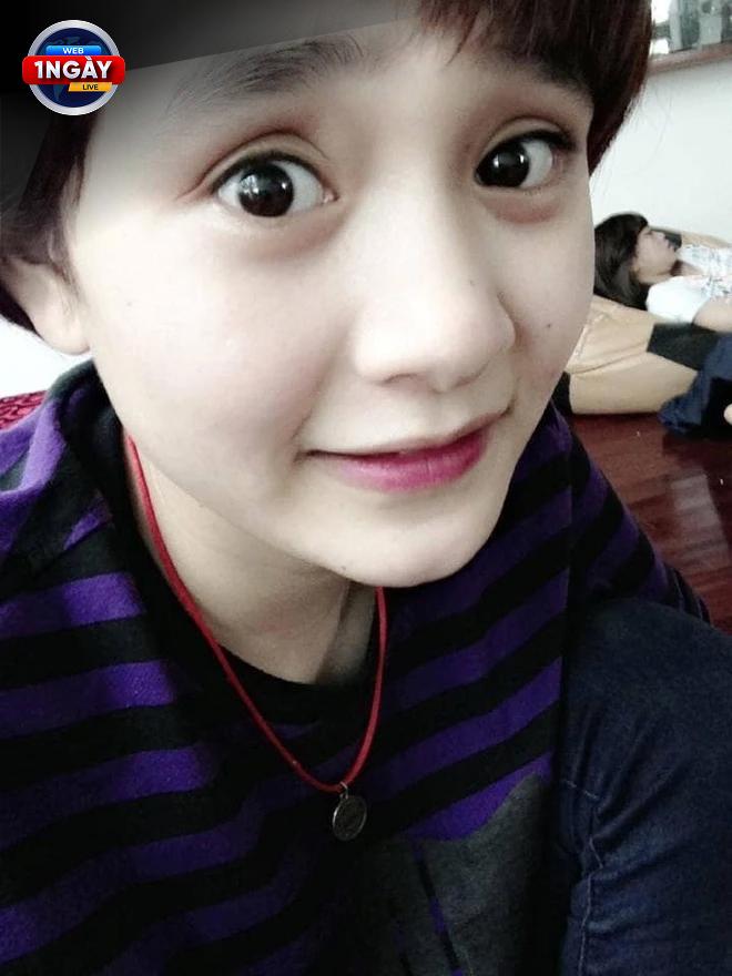 Lưu Ý Quan Trọng Để Tiêm Filler An Toàn Và Hiệu Quả