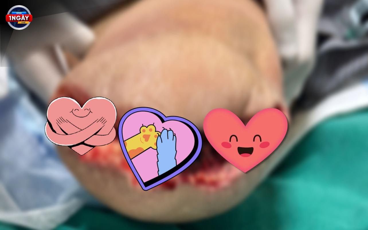 Giảm thiểu phơi nhiễm vi nhựa: Vì một tương lai khỏe mạnh