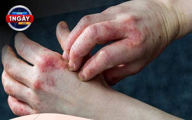 Chăm Sóc Bàn Chân Đúng Cách Giúp Ngăn Ngừa Biến Chứng Tiểu Đường