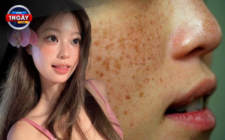 Giải Đáp Thắc Mắc Thường Gặp Về Kem Chống Nắng