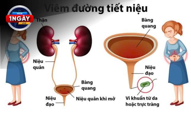 Biến Chứng Nguy Hiểm: Đừng Để Sự Chủ Quan 